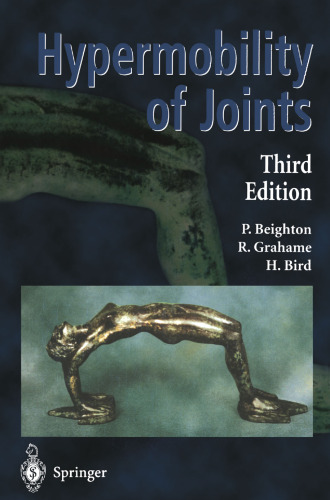 Hypermobility of Joints