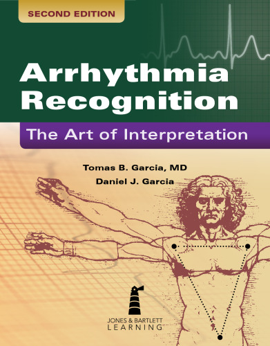 Arrhythmia Recognition: The Art of Interpretation