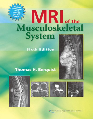 Berquist, T: MRI of the Musculoskeletal System