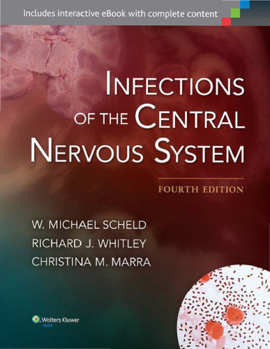 Infection of the Central Nervous System
