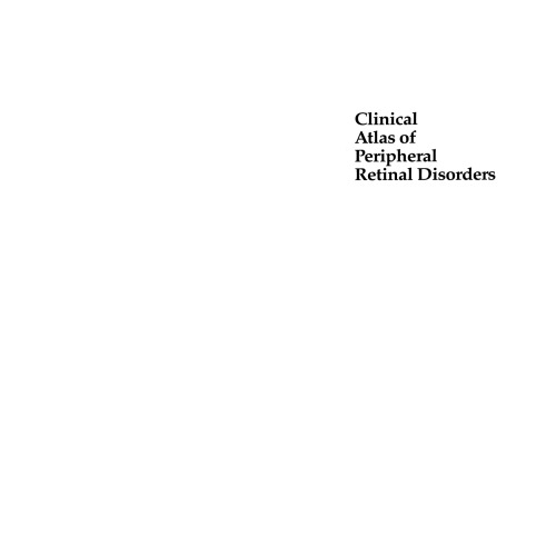 Clinical Atlas of Peripheral Retinal Disorders