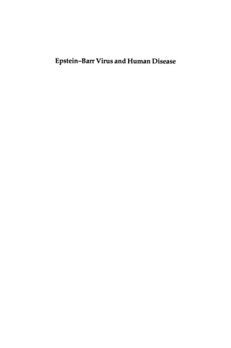 Epstein-Barr Virus and Human Disease