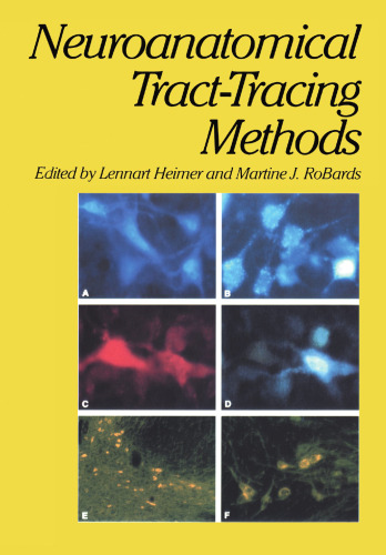 Neuroanatomical Tract-Tracing Methods