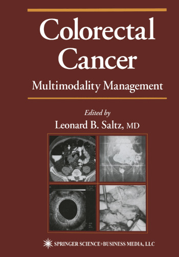 Colorectal Cancer: Multimodality Management