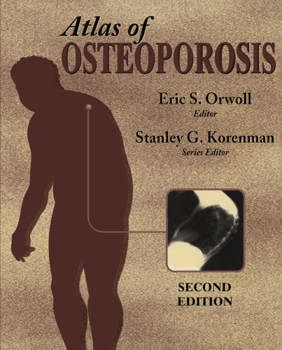 Atlas of Osteoporosis