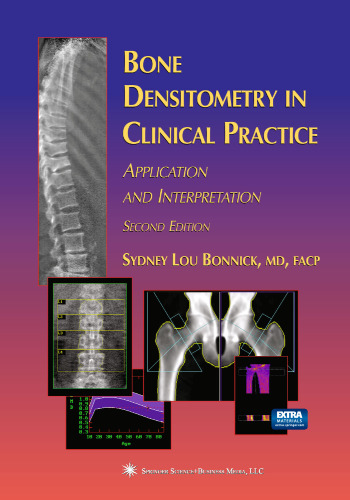 Bone Densitometry in Clinical Practice: Application and Interpretation