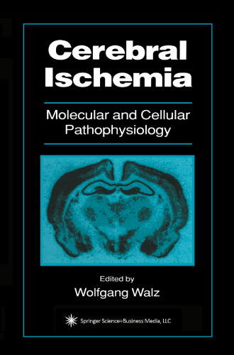 Cerebral Ischemia: Molecular and Cellular Pathophysiology