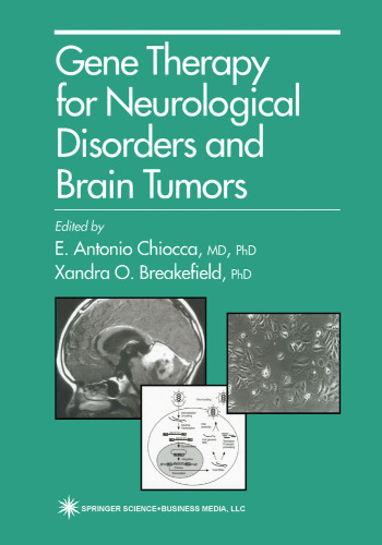 Gene Therapy for Neurological Disorders and Brain Tumors