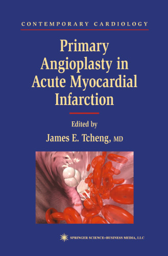 Primary Angioplasty in Acute Myocardial Infarction