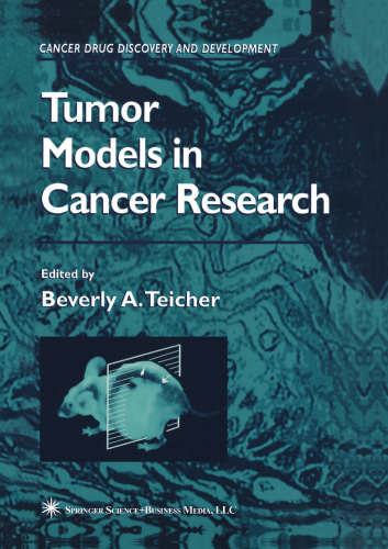 Tumor Models in Cancer Research