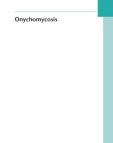 Onychomycosis: The Current Approach to Diagnosis and Therapy