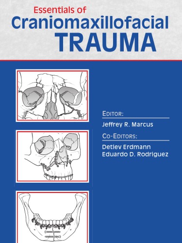Essentials of Craniomaxillofacial Trauma