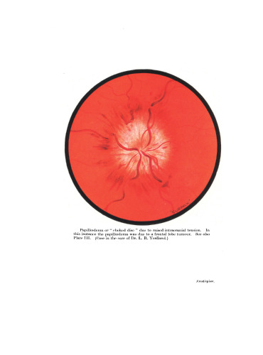 Neuro-Ophthalmology