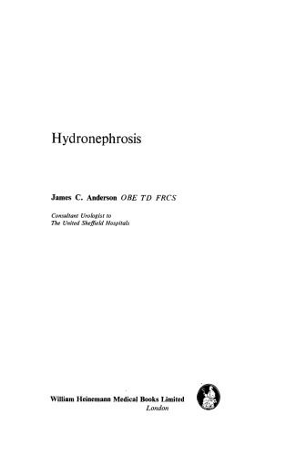 Hydronephrosis