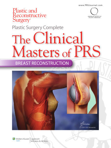 Plastic Surgery Complete: The Clinical Masters of PRS: Breast Reconstruction