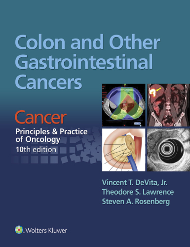 Colon and Other Gastrointestinal Cancers - Cancer - Principles & Practice of Oncology, 10e (May 26, 2016)_(1496333969)_(LWW)