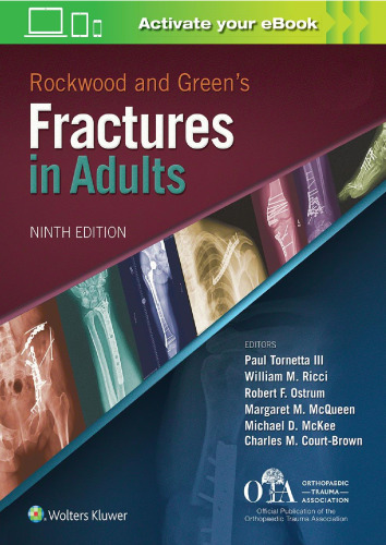 Rockwood and Green's Fractures in Adults