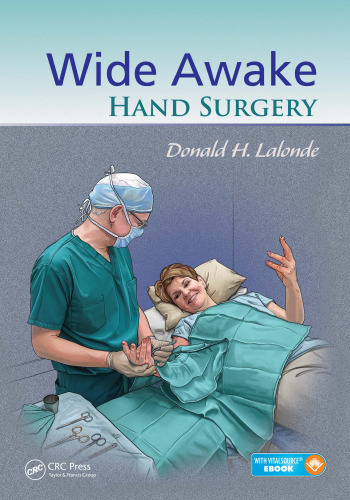 Wide awake hand surgery