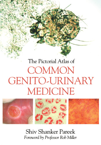 The pictorial atlas of common genito-urinary medicine
