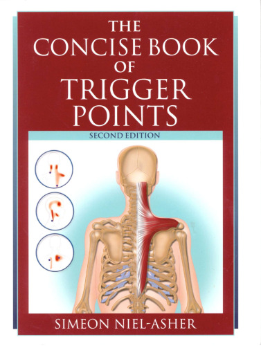 The Concise Book of Trigger Points, Revised Edition