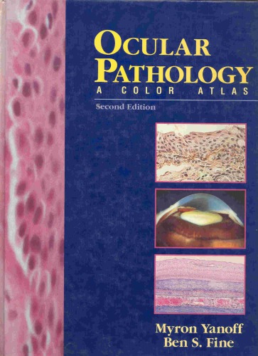 Ocular pathology : a color atlas