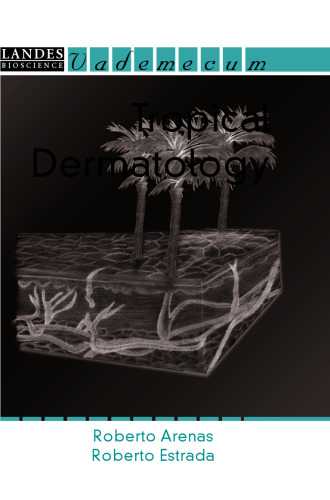 Tropical Dermatology.