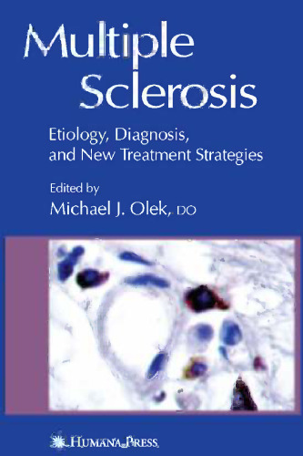 Multiple Sclerosis: Etiology, Diagnosis, and New Treatment Strategies