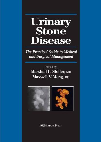 Urinary Stone Disease The Practical Guide to Medical and Surgical Management