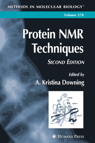Protein NMR Techniques