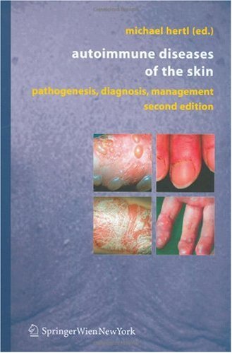 Atypical Parkinsonian Disorders: Clinical and Research Aspects