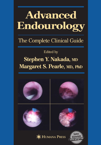 Advanced Endourology: The Complete Clinical Guide