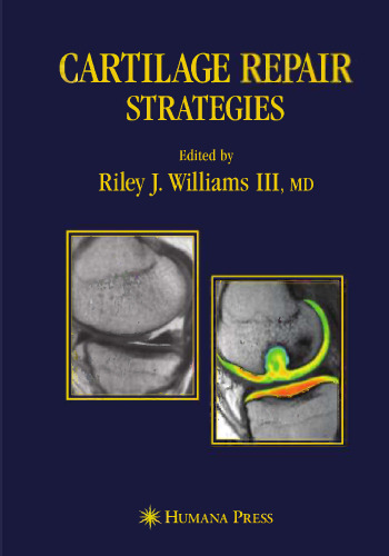 Cartilage Repair Strategies