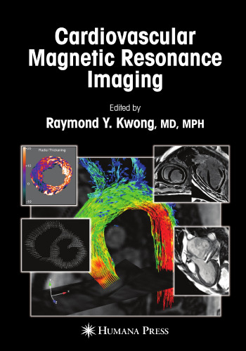 Cardiovascular Magnetic Resonance Imaging