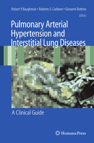 Pulmonary Arterial Hypertension and Interstitial Lung Diseases: A Clinical Guide