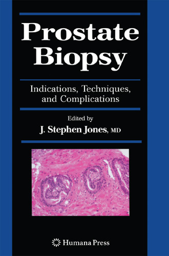 Prostate Biopsy: Indications, Techniques, and Complications