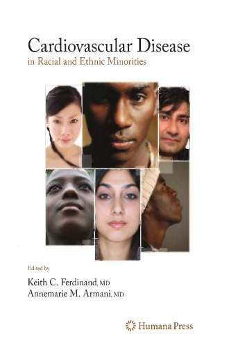 Cardiovascular Disease in Racial and Ethnic Minorities