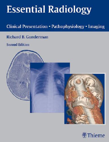 Essential Radiology: Clinical Presentation Pathophysiology Imaging