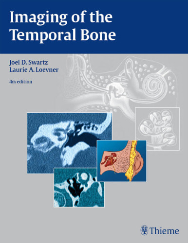 Imaging of the temporal bone