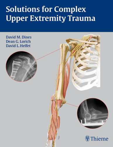 Solutions for complex upper extremity trauma
