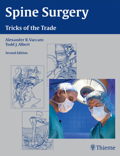 Spine surgery: tricks of the trade