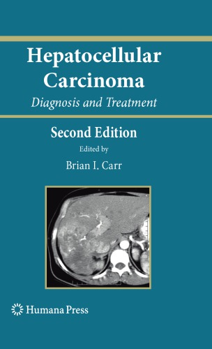 Hepatocellular Carcinoma: Diagnosis and Treatment