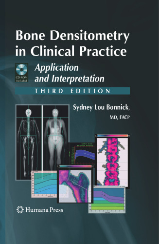 Bone Densitometry in Clinical Practice: Application and Interpretation