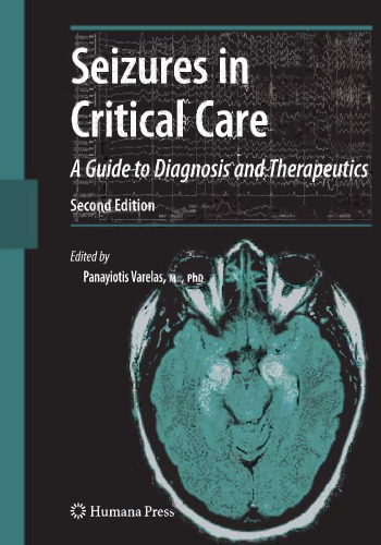 Seizures in Critical Care: A Guide to Diagnosis and Therapeutics