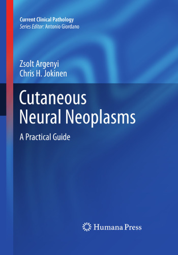 Cutaneous Neural Neoplasms: A Practical Guide