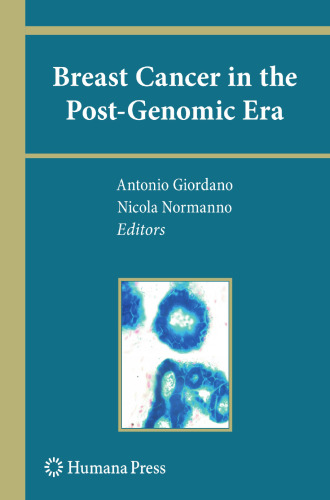Breast Cancer in the Post-Genomic Era