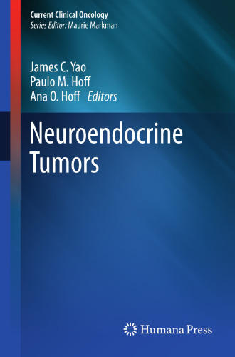 Neuroendocrine Tumors