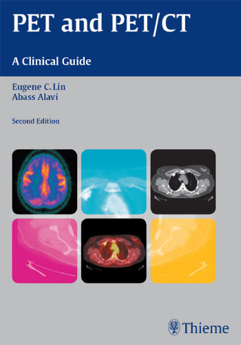 PET and PET/CT: a clinical guide