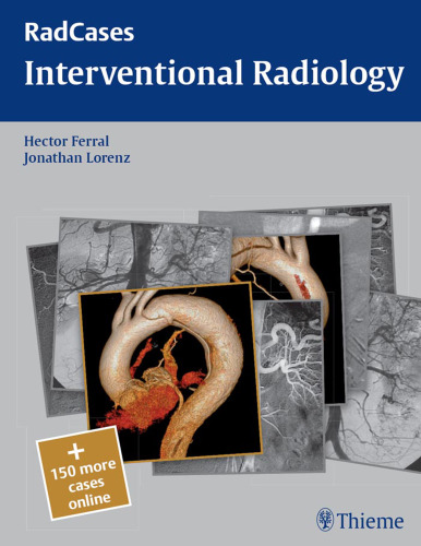 Interventional radiology
