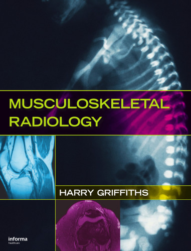 Musculoskeletal radiology