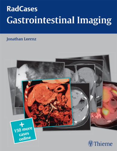 Gastrointestinal Imaging (Radcases Plus Q&A)